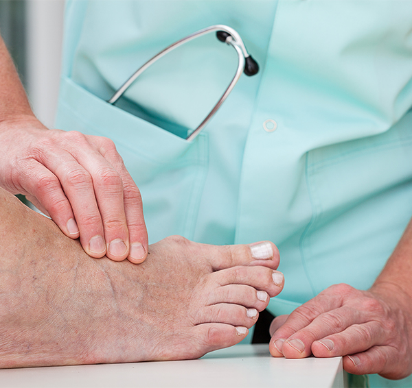 The Foot and Ankle Center of Issaquah | Gout, Hammertoe and Flat Feet